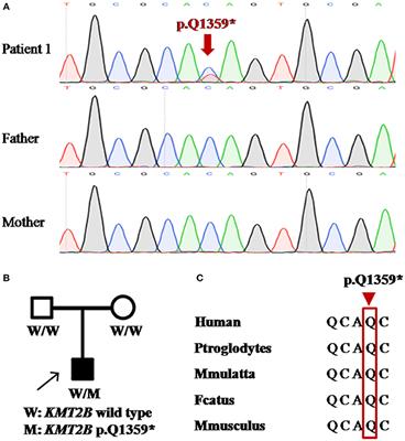 Identification of Novel KMT2B Variants in Chinese Dystonia Patients via Whole-Exome Sequencing